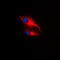 LCK Proto-Oncogene, Src Family Tyrosine Kinase antibody, GTX55100, GeneTex, Immunofluorescence image 