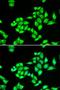 TPD52 Like 1 antibody, LS-C334701, Lifespan Biosciences, Immunofluorescence image 