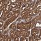 TELO2 Interacting Protein 2 antibody, HPA029823, Atlas Antibodies, Immunohistochemistry paraffin image 