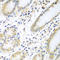 Interleukin 5 antibody, A01086-1, Boster Biological Technology, Immunohistochemistry paraffin image 