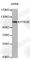 Protein Tyrosine Kinase 2 Beta antibody, A0074, ABclonal Technology, Western Blot image 