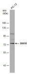 Sorting Nexin 18 antibody, GTX119426, GeneTex, Western Blot image 