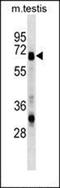 Syncytin antibody, orb103562, Biorbyt, Western Blot image 
