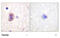 Mitogen-Activated Protein Kinase Kinase 4 antibody, MBS839084, MyBioSource, Immunohistochemistry paraffin image 