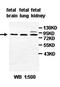 Zinc Finger CCCH-Type Containing 11A antibody, orb77680, Biorbyt, Western Blot image 