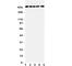 Inositol 1,4,5-Trisphosphate Receptor Type 1 antibody, R31394, NSJ Bioreagents, Western Blot image 