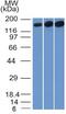 DNA Topoisomerase II Alpha antibody, GTX35137, GeneTex, Western Blot image 