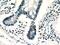 Zinc Finger And SCAN Domain Containing 20 antibody, 20855-1-AP, Proteintech Group, Immunohistochemistry paraffin image 