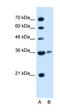 Arginase 1 antibody, orb330438, Biorbyt, Western Blot image 