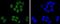 SUZ12 Polycomb Repressive Complex 2 Subunit antibody, NBP2-67888, Novus Biologicals, Immunocytochemistry image 