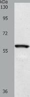 Solute Carrier Family 5 Member 1 antibody, TA324225, Origene, Western Blot image 