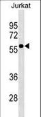CD1a Molecule antibody, LS-C159301, Lifespan Biosciences, Western Blot image 
