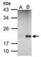 p21 antibody, PA5-34805, Invitrogen Antibodies, Western Blot image 