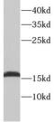 Troponin C1, Slow Skeletal And Cardiac Type antibody, FNab08835, FineTest, Western Blot image 