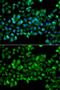 Carbonyl Reductase 3 antibody, GTX64745, GeneTex, Immunofluorescence image 