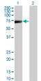Keratin 5 antibody, LS-C197587, Lifespan Biosciences, Western Blot image 