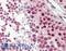 Cold Inducible RNA Binding Protein antibody, LS-B8341, Lifespan Biosciences, Immunohistochemistry paraffin image 