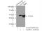 Ubiquinol-Cytochrome C Reductase Core Protein 2 antibody, 14742-1-AP, Proteintech Group, Immunoprecipitation image 