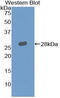 Leukocyte Immunoglobulin Like Receptor A2 antibody, MBS2013497, MyBioSource, Western Blot image 