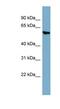 Alanine--Glyoxylate Aminotransferase 2 antibody, NBP1-79303, Novus Biologicals, Western Blot image 