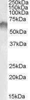 Corticotropin Releasing Hormone Receptor 1 antibody, PA5-18801, Invitrogen Antibodies, Western Blot image 