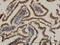 Cell Death Inducing DFFA Like Effector B antibody, LS-C133723, Lifespan Biosciences, Immunohistochemistry paraffin image 