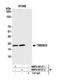 Transmembrane Protein 33 antibody, NBP2-59137, Novus Biologicals, Western Blot image 