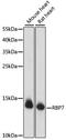 Retinol Binding Protein 7 antibody, A15939, ABclonal Technology, Western Blot image 