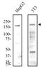 Lysine Demethylase 6B antibody, NBP1-06640, Novus Biologicals, Western Blot image 