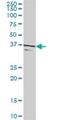 Testis Specific Serine Kinase 2 antibody, H00023617-D01P, Novus Biologicals, Western Blot image 