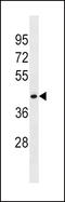 Flotillin 1 antibody, LS-C159664, Lifespan Biosciences, Western Blot image 