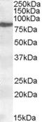 Arachidonate 15-Lipoxygenase antibody, LS-B6689, Lifespan Biosciences, Western Blot image 