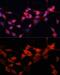 Damage Specific DNA Binding Protein 1 antibody, GTX32555, GeneTex, Immunofluorescence image 