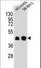 Keratin 80 antibody, LS-C165641, Lifespan Biosciences, Western Blot image 