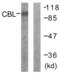 Cbl Proto-Oncogene antibody, LS-C117635, Lifespan Biosciences, Western Blot image 