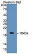 Cellular Retinoic Acid Binding Protein 1 antibody, LS-C374462, Lifespan Biosciences, Western Blot image 