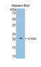 IRP1 antibody, LS-C292598, Lifespan Biosciences, Western Blot image 