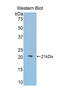 Aconitase 1 antibody, LS-C292598, Lifespan Biosciences, Western Blot image 