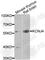 Potassium Voltage-Gated Channel Subfamily J Member 4 antibody, A8434, ABclonal Technology, Western Blot image 