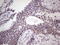 Basic Helix-Loop-Helix Family Member E41 antibody, LS-C790802, Lifespan Biosciences, Immunohistochemistry paraffin image 