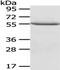 X-Linked Inhibitor Of Apoptosis antibody, TA351943, Origene, Western Blot image 