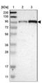 Sad1 And UNC84 Domain Containing 1 antibody, NBP1-87396, Novus Biologicals, Western Blot image 