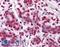 Vitamin D Receptor antibody, LS-B4449, Lifespan Biosciences, Immunohistochemistry frozen image 
