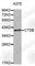 Cathepsin B antibody, A0061, ABclonal Technology, Western Blot image 