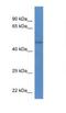 Serine/Threonine Kinase 32B antibody, NBP1-74225, Novus Biologicals, Western Blot image 