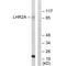 Von Willebrand Factor A Domain Containing 5A antibody, A13975, Boster Biological Technology, Western Blot image 