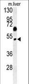 Sorting Nexin 31 antibody, LS-C161373, Lifespan Biosciences, Western Blot image 