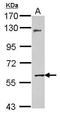 Matrix Metallopeptidase 8 antibody, GTX105428, GeneTex, Western Blot image 