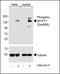 Protein Phosphatase 1 Regulatory Subunit 12A antibody, GTX00776, GeneTex, Western Blot image 