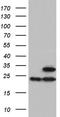 ATP Synthase Peripheral Stalk Subunit OSCP antibody, NBP2-46555, Novus Biologicals, Western Blot image 